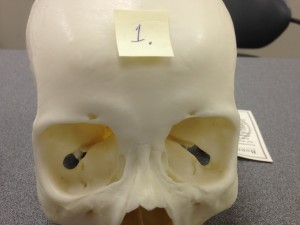 Point 1 on the skull labels the Frontal Bone which is viewed from the anterior (front) part of the skull.