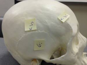 Point 4 points to the temporal line which is viewed from the lateral side of the skull. Point 5 is the squamosal suture that is also seen from the lateral side of the skull. Point 6 is the temporal bone that is viewed from the lateral side of the skull.