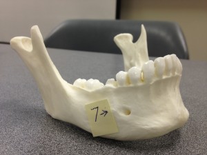 Point 7 points to the mental foramen which is where the blood vessal enters the skull's jaw which is seen on the skull's anterior (front)  position but is inferior (below) the skull's teeth.