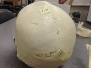Point 8 points to the sagittal suture that separates the skull into right and left from the superior (top) view of the skull while Point 9 at the skull's posteiror (back)  points to the occipital bone.