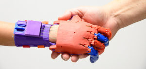 A closeup of Lucy’s new hand. She chose the color scheme. | Photo by CJ South A closeup of Lucy’s new hand. She chose the color scheme. | Photo by CJ South