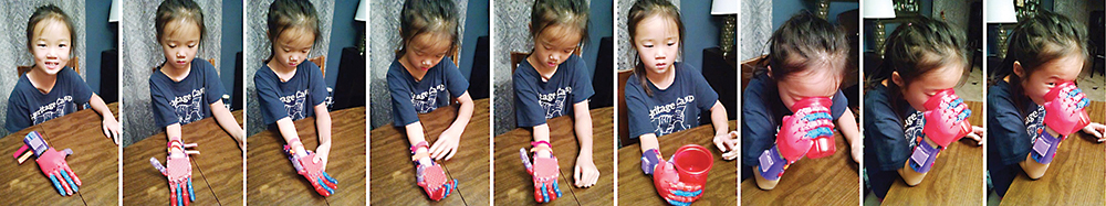 Lucy puts on her hand and takes a drink of water in this series of photos shared by the Winkler family.